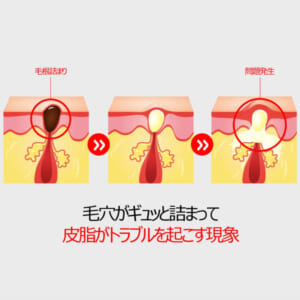 スキンソリューションSOS AMPOULE